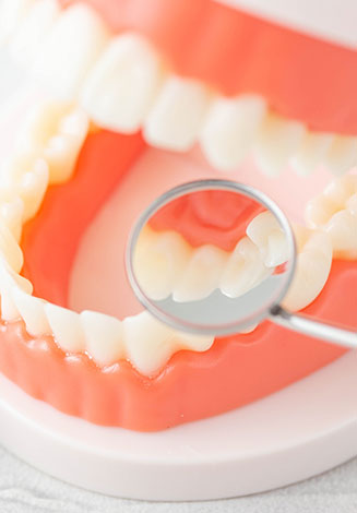 親知らずの抜歯にも対応