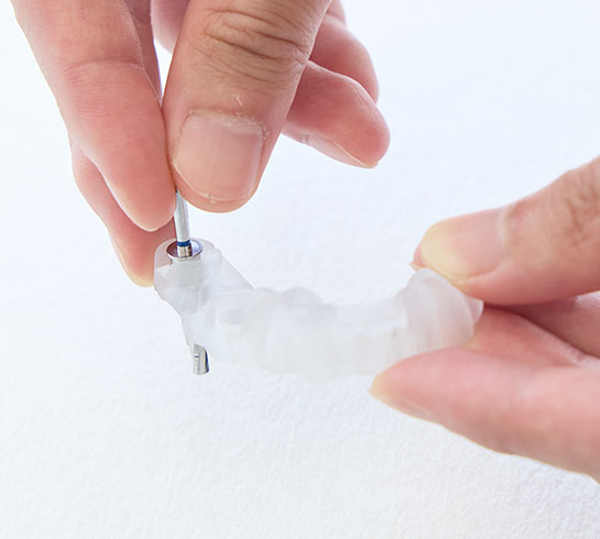 骨造成も同日におこなえるのでしょうか？